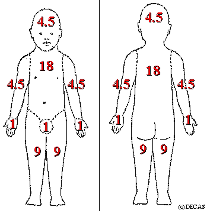 成人及2岁以上儿童特应性皮炎各部位占体表面积比例示意图