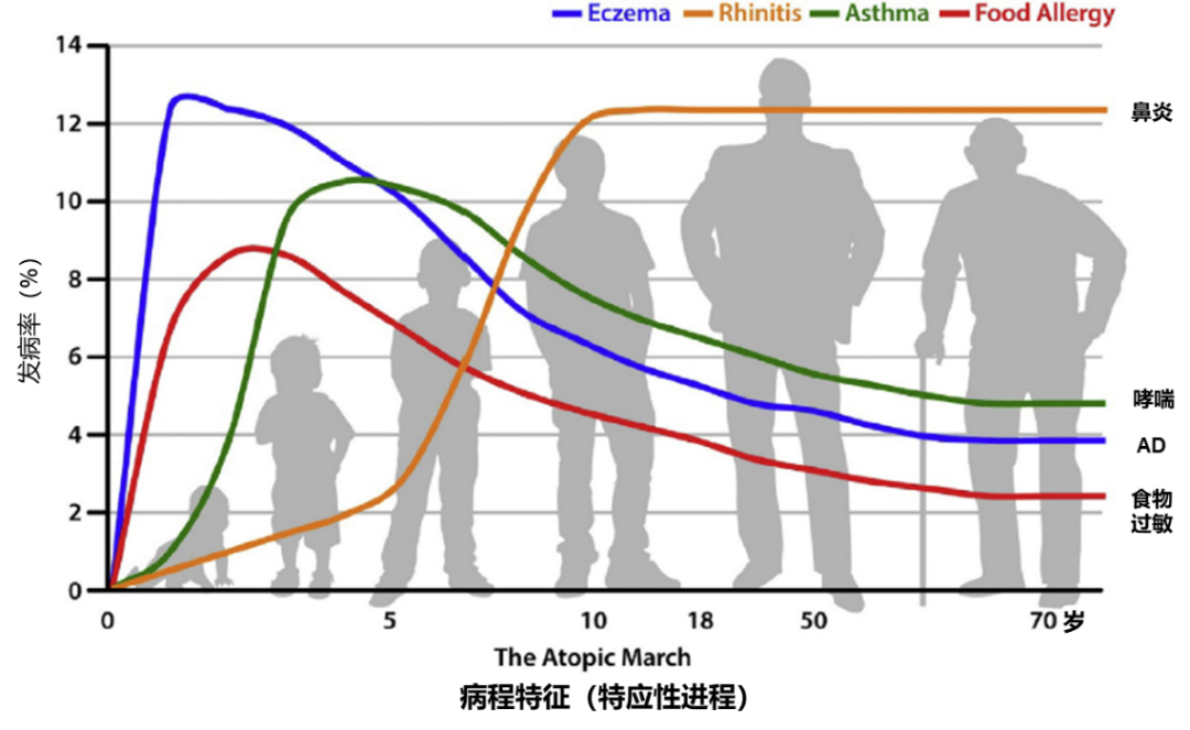 特应性皮炎病程特征