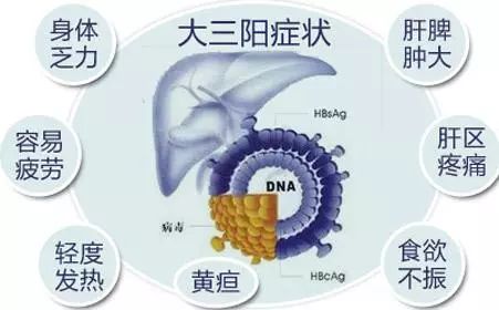 乙肝大三阳的症状