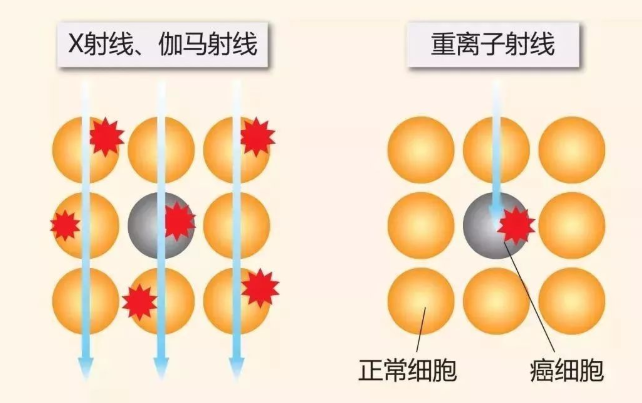 不同放疗射线对比